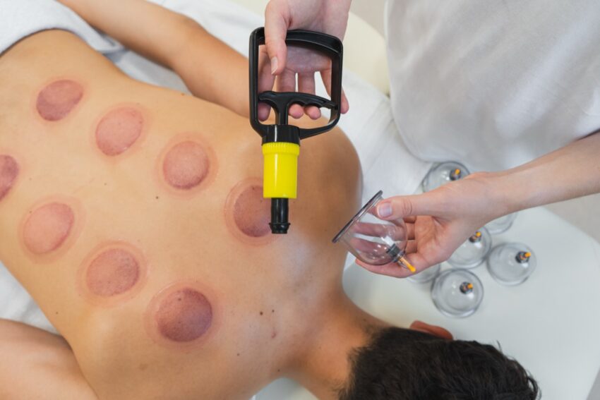 Bankovanie (vákuová terapia)